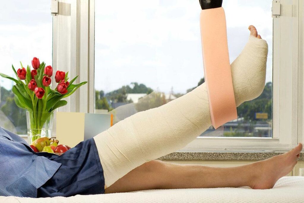 عظام الساق .. كسر الساق .. مدة التئام عظام الساق و طرق العلاج
