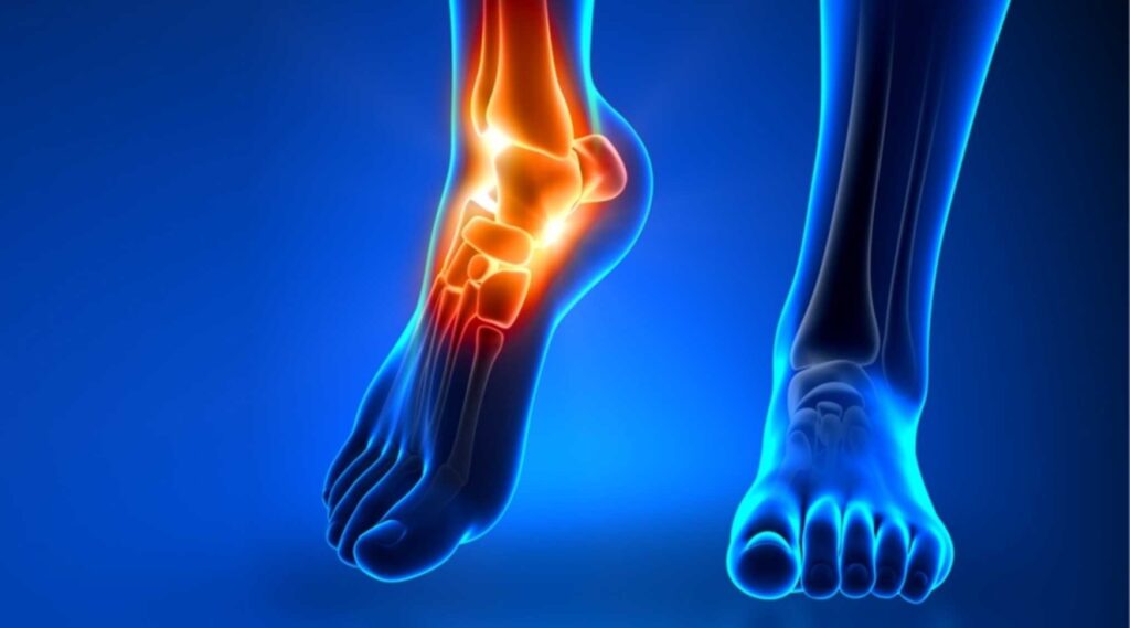 عظام القدم .. مم تتكون القدم؟ و ما هي أشهر الإصابات و الأمراض التي تصيب عظام القدم؟
