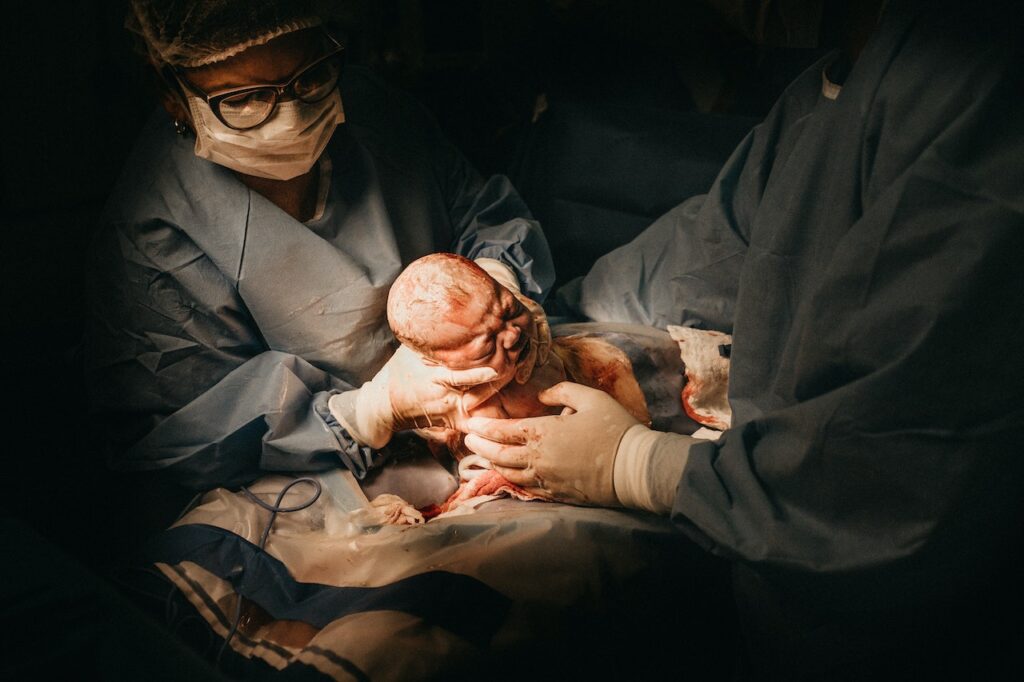 حالات لا تجوز فيها الولادة الطبيعية.. متى يقرر الطبيب الولادة القيصرية