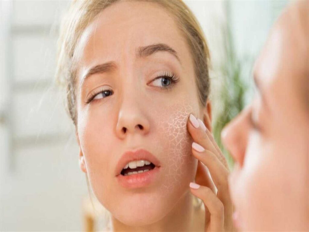 أسباب جفاف وخشونة الوجه .. ما هو علاج جفاف الجلد الشديد؟